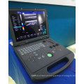 Venda quente e de alta qualidade 3D sistema de máquina de ecografia vascular / 3D sistema de dispositivo de ultra-som doppler com Boa Qualidade